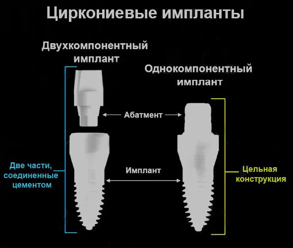 Циркониевые зубные импланты