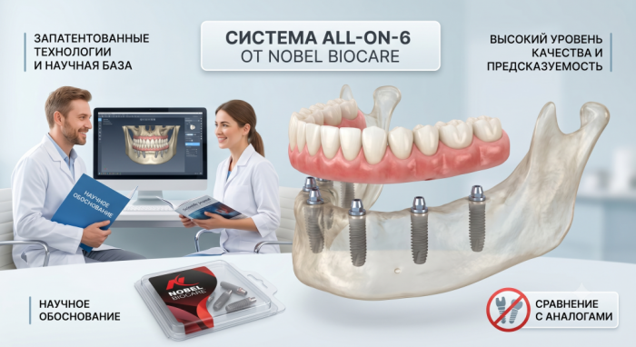 Зубные импланты для All-on-6 и аналоги системы