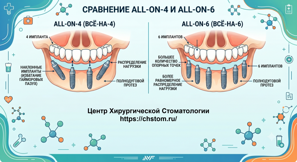 сравнение All-on-4 и All-on-6