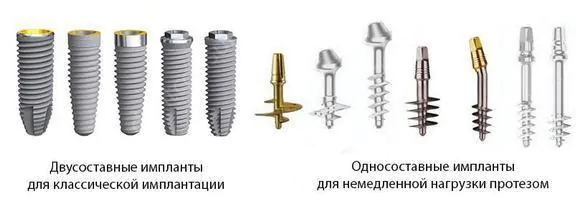 виды имплантов