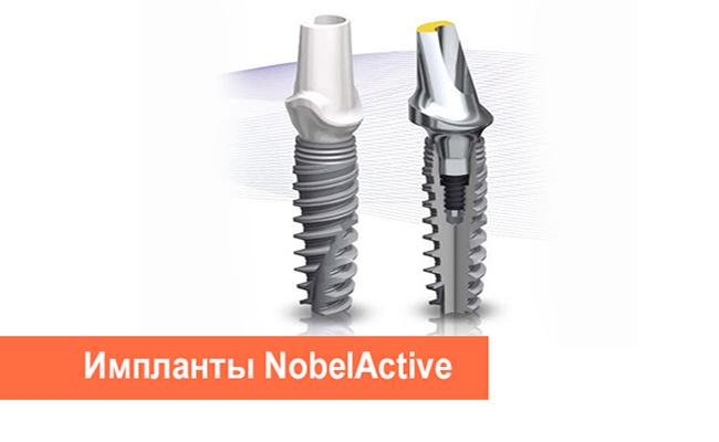 Какие импланты лучше Nobel-Active
