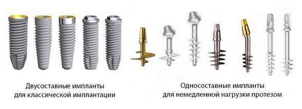 vidi_implantov
